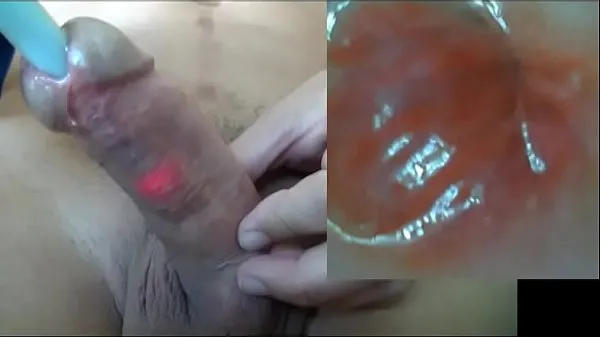 Dysk HD Exploring Urethra with Cam Tube