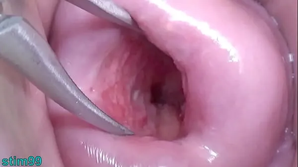 Tubo de unidad HD Japanese Wife Open Cervix Wide to watch inside Uterus